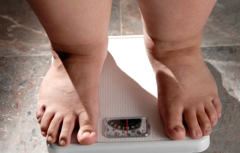 Obesidade Grau II ou III